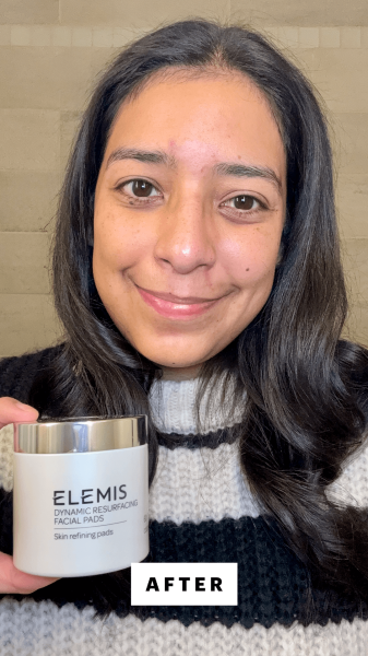Foresto after applying the Elemis Dynamic Resurfacing Facial Pads